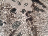 Diploschistes diacapsis image