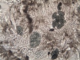 Diploschistes diacapsis image