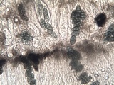 Diploschistes diacapsis image