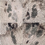 Diploschistes diacapsis image