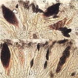 Diploschistes diacapsis image