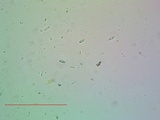 Lecanora expallens image
