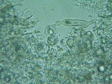 Acanthobasidium penicillatum image