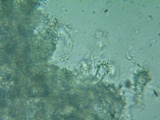 Acanthobasidium penicillatum image
