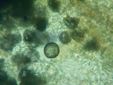 Acanthobasidium penicillatum image