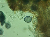 Acanthobasidium penicillatum image