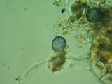 Acanthobasidium penicillatum image
