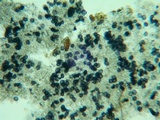 Acanthobasidium penicillatum image