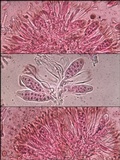 Caloplaca flavescens image