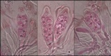 Caloplaca flavescens image