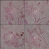 Caloplaca flavescens image