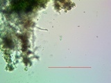 Lecanora expallens image