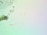Lecanora expallens image
