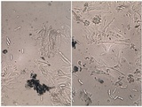 Skyttea pertusariicola image