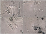 Skyttea pertusariicola image
