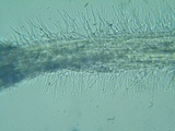 Tilachlidium brachiatum image