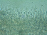 Tilachlidium brachiatum image