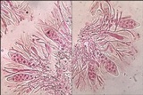 Caloplaca aurantia image