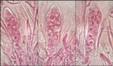 Caloplaca aurantia image