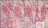 Caloplaca aurantia image