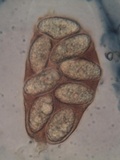 Verrucaria muralis image