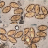 Verrucaria muralis image