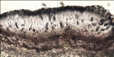 Amandinea punctata image