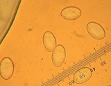Peziza repanda image