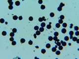Elaphomyces granulatus image