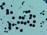 Elaphomyces granulatus image