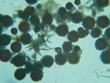 Elaphomyces granulatus image