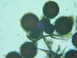 Elaphomyces granulatus image