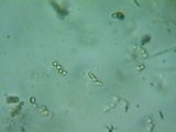 Guepiniopsis alpina image