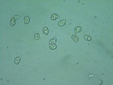 Nolanea holoconiota image