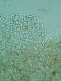 Rutstroemia conformata image