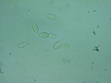 Rutstroemia conformata image