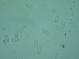 Rutstroemia conformata image