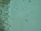 Rutstroemia conformata image