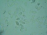 Rutstroemia conformata image