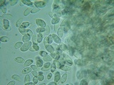 Rutstroemia conformata image