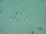 Rutstroemia conformata image