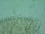 Rhodocybe aureicystidiata image