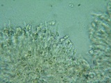 Rhodocybe aureicystidiata image
