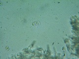Rhodocybe aureicystidiata image