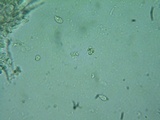 Rhodocybe aureicystidiata image