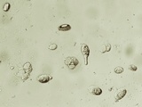 Morchella diminutiva image