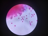 Dichostereum sordulentum image