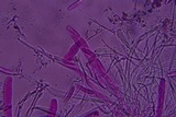 Propolis farinosa image