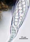 Opegrapha pulvinata image