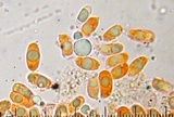 Tricholoma moseri image